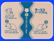 モーラステープ20mg