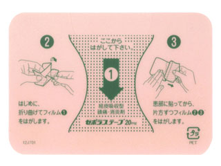 ゼポラステープ20mg